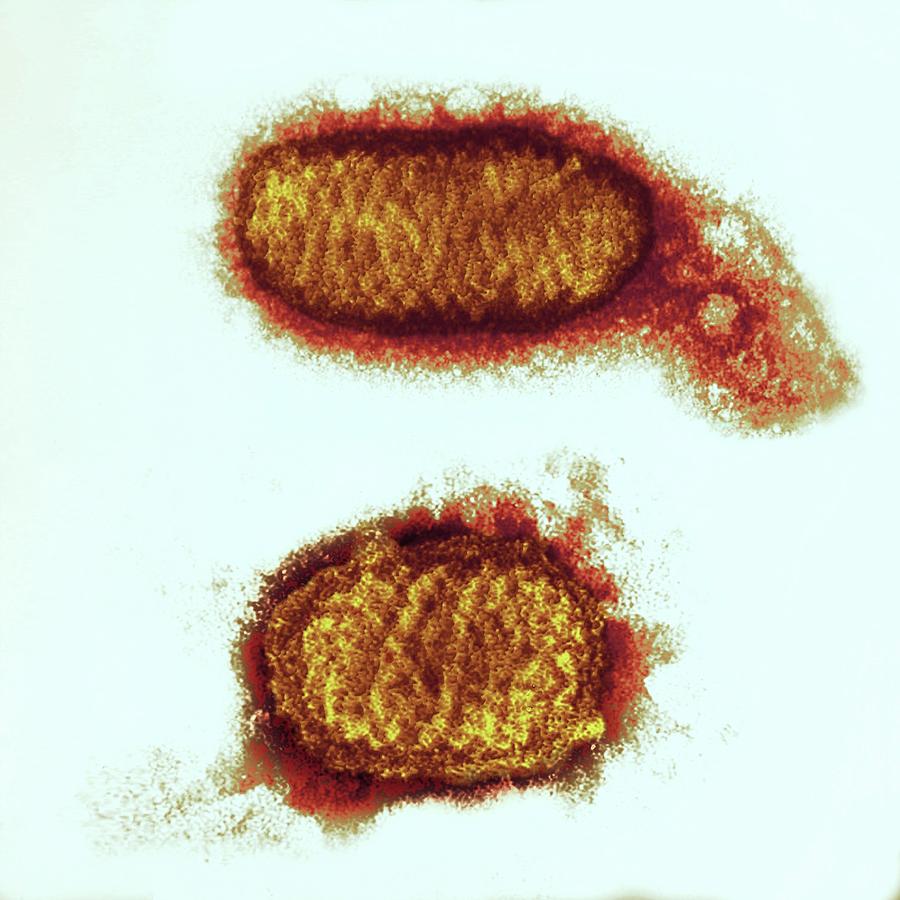 Sheep Photograph - Orf Virus Particles by Ami Images