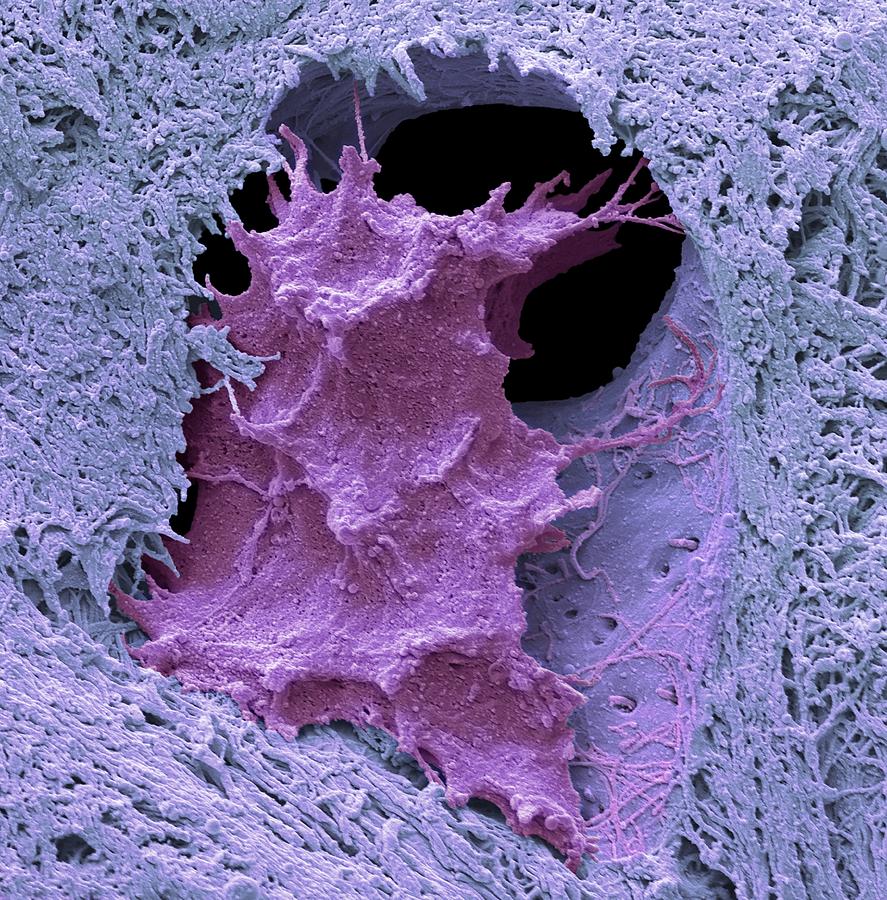 Osteocyte bone cell, SEM Photograph by Steve Gschmeissner/science Photo Library