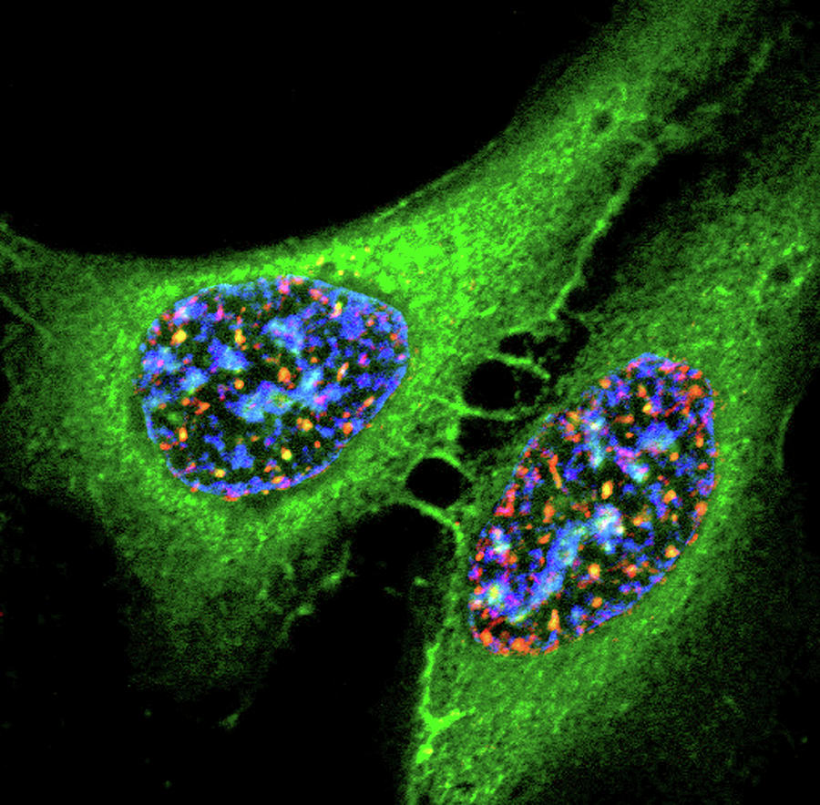 Osteosarcoma Cells Photograph by Nci Center For Cancer Research/national Cancer Institute/science Photo Library