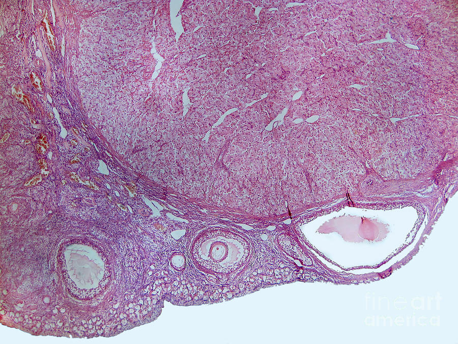 Ovarian Follicles And Corpus Luteum, Lm Photograph by Garry DeLong