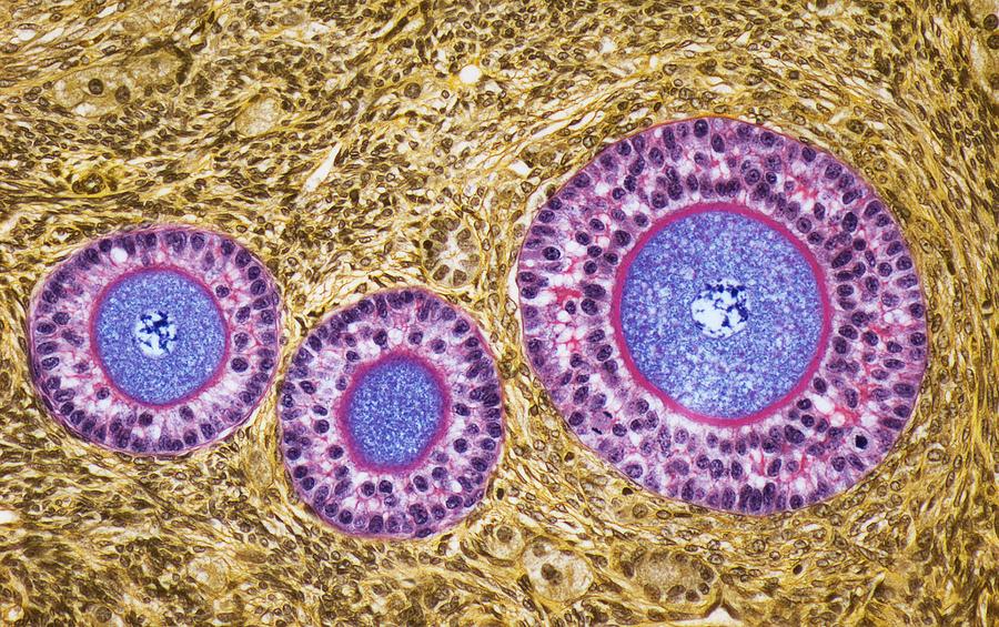 Ovarian follicles, LM Photograph by Steve Gschmeissner/science Photo Library