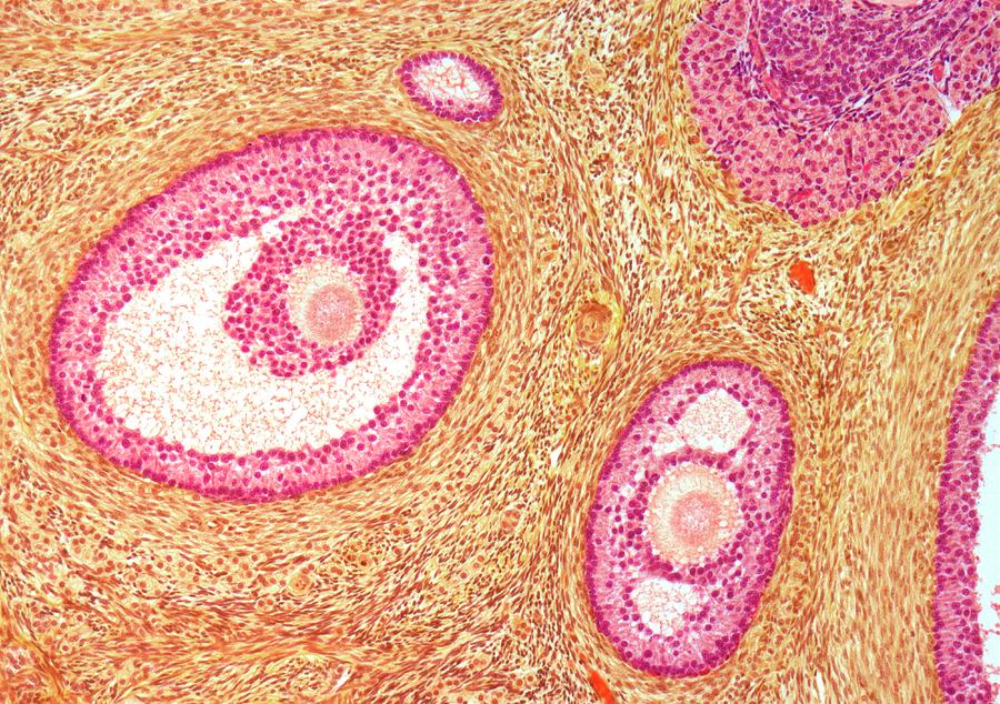 difference-between-primary-follicle-and-tertiary-follicle-biologysir