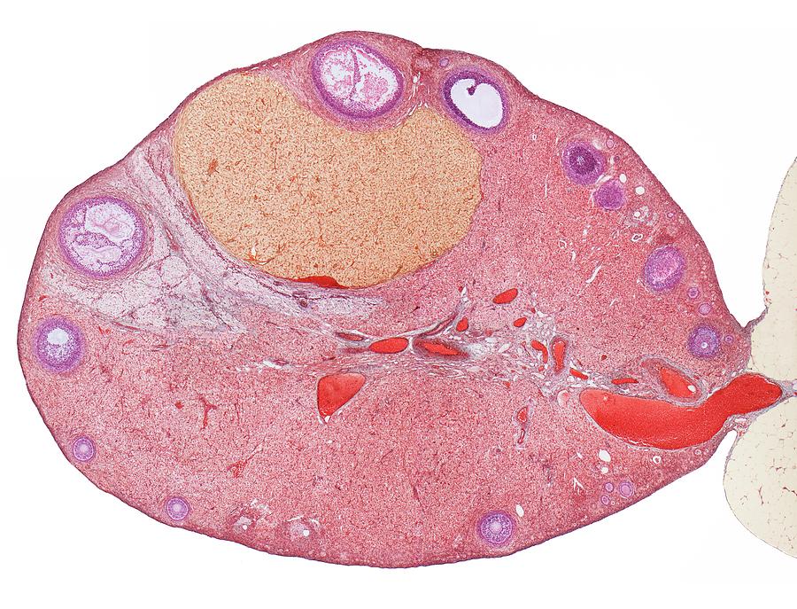 Animal Reproduction Photograph - Ovary by Steve Gschmeissner