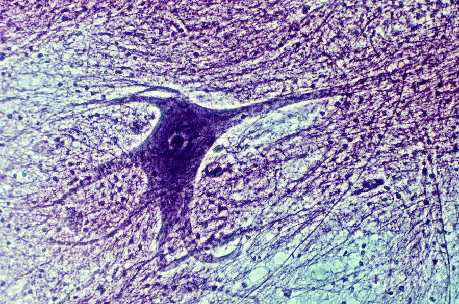 Ox Spinal Cord Photograph by Robert Knauft / Biology Pics