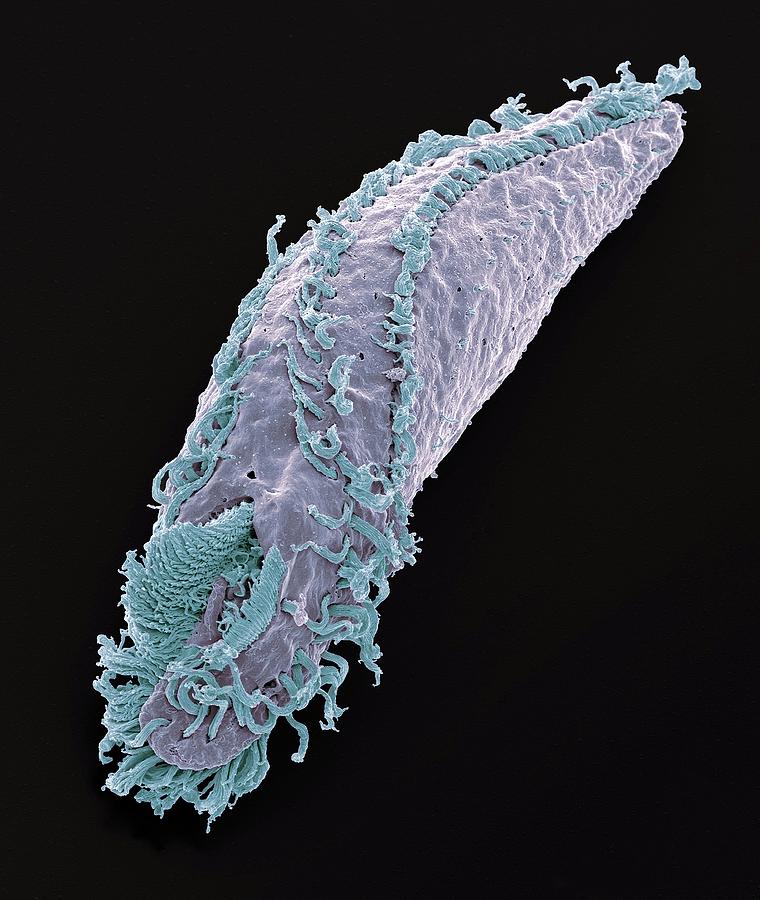 Nature Photograph - Oxytricha Ciliate Protozoan by Steve Gschmeissner