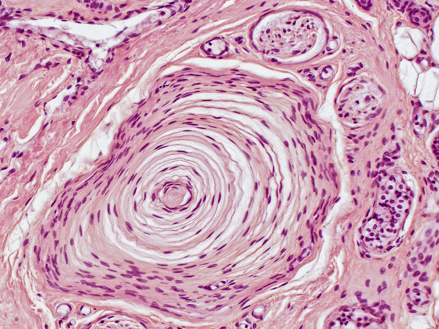 Pacinian Corpuscle Lm Photograph by Alvin Telser