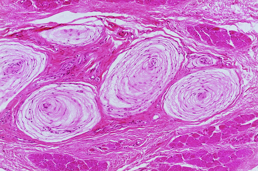 Pacinian Corpuscles Photograph by Innerspace Imaging/science Photo Library