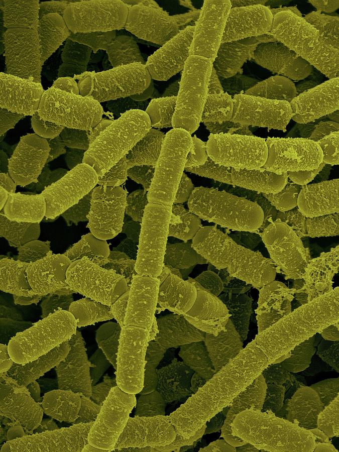 Paenibacillus Amylolyticus Photograph by Dennis Kunkel Microscopy/science Photo Library