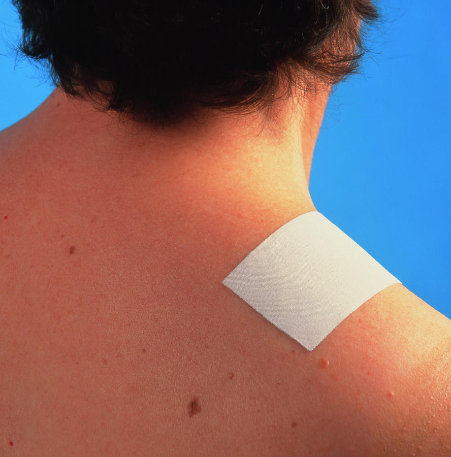 Pain-relief Patch On A Patients Shoulder Photograph by Sheila Terry/science Photo Library