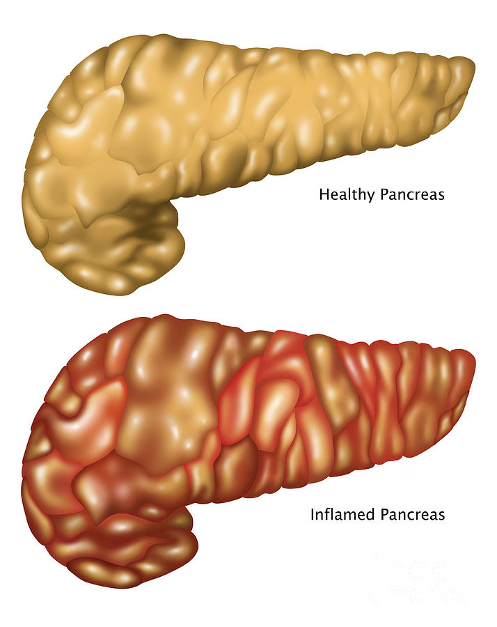 Pancreas Illustration, Healthy & Photograph by Gwen Shockey - Fine Art ...