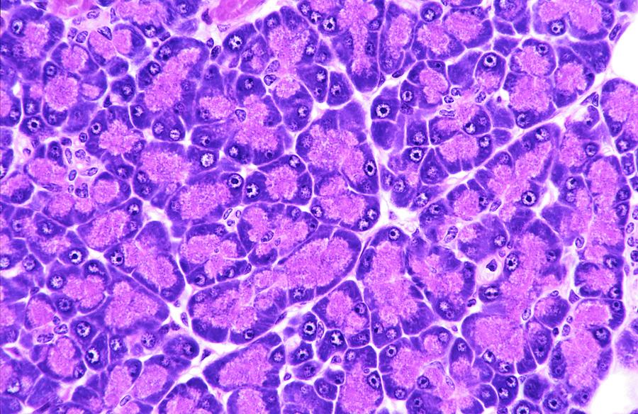 Pancreas Photograph by Microscape
