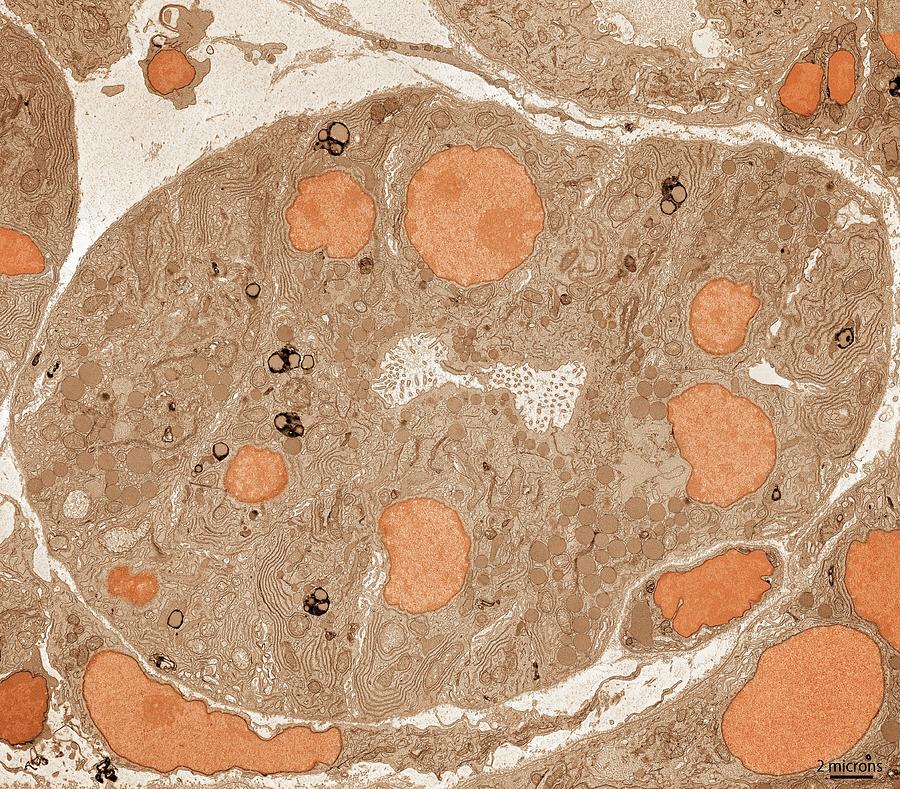 Pancreatic Acinar Cells Photograph by Thomas Deerinck, Ncmir/science Photo Library