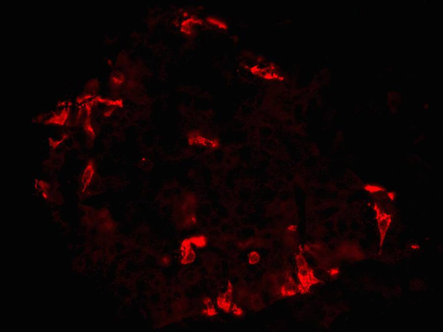 Pancreatic Islet Stained For D Cells Lm Photograph by Alvin Telser