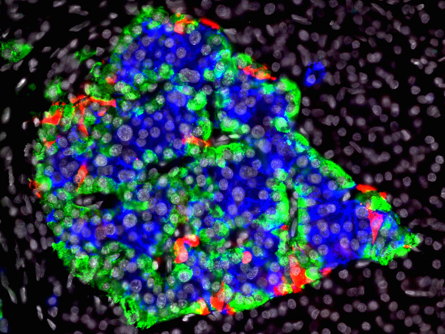 Pancreatic Islet With Fluorescent Photograph by Alvin Telser