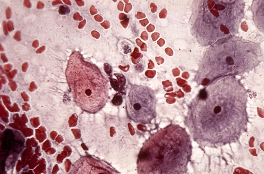 Pap Smear Photograph by Biology Pics
