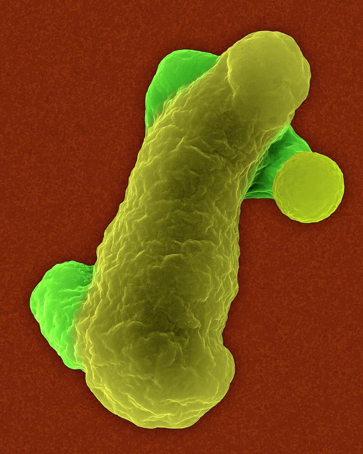 Animal Photograph - Parasitic Amoeba (entamoeba Histolytica) by Dennis Kunkel Microscopy/science Photo Library