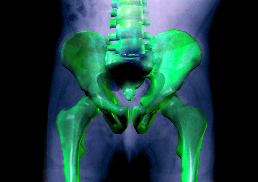 Skeleton Photograph - Pelvis X-ray by Aj Photo/science Photo Library