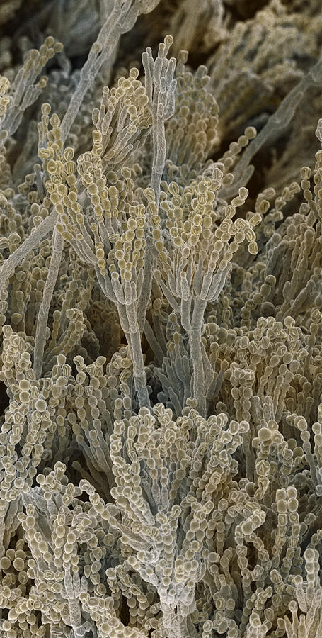 Nature Photograph - Penicillium Fungal Spores, Sem by Power And Syred