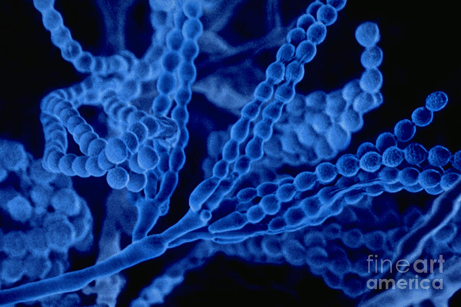 Enhanced Photograph - Penicillium With Spores by Scimat