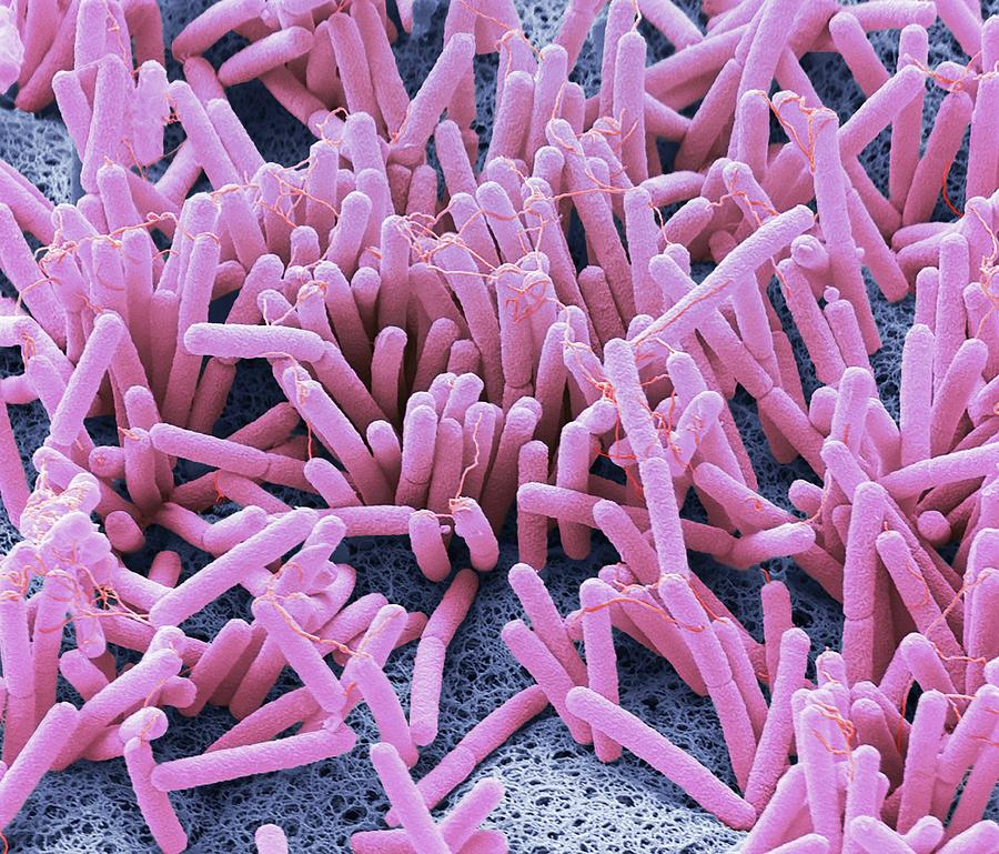 Penile Bacteria Photograph by Steve Gschmeissner/science Photo Library ...