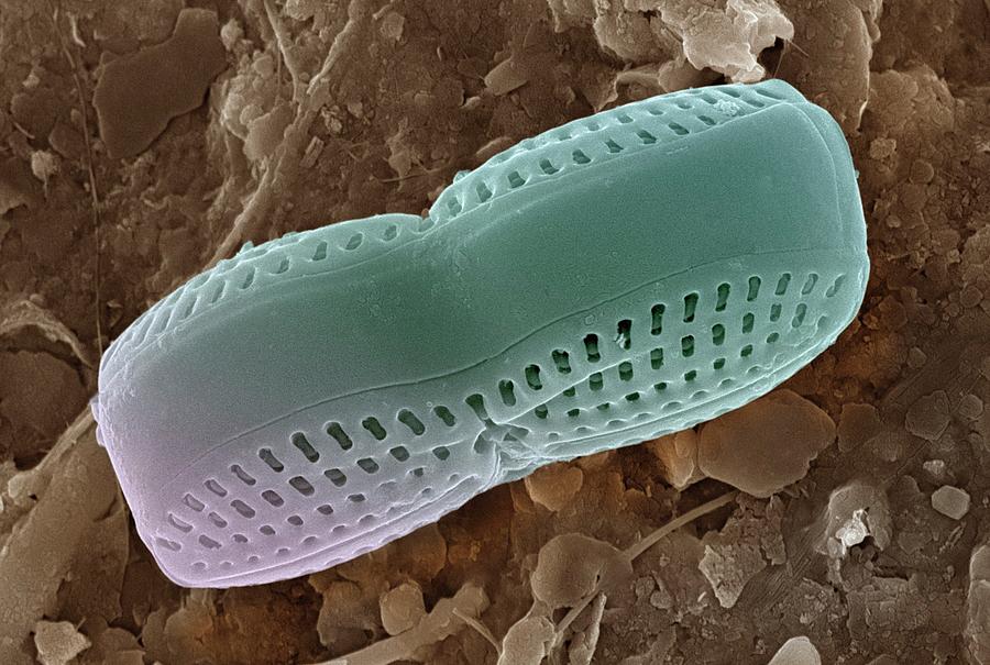 Pennate Diatom Photograph by Ami Images