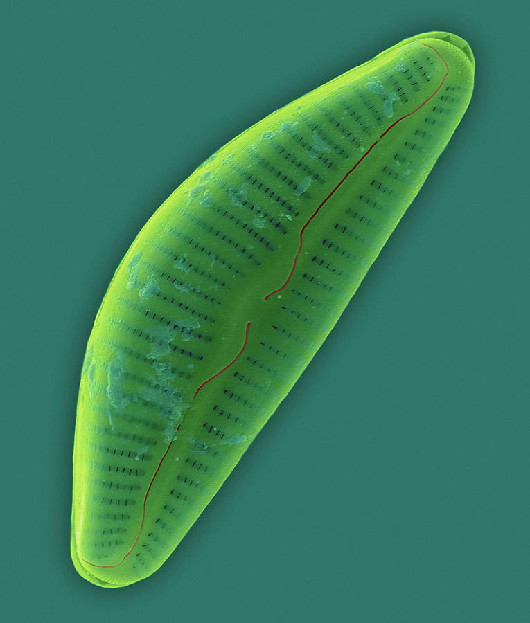 Pennate Marine Diatom (cymbella Sp.) Photograph by Dennis Kunkel Microscopy/science Photo Library