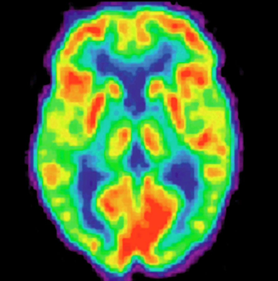 Pet Scan Of A Normal Brain Photograph by Science Stock Photography/science Photo Library
