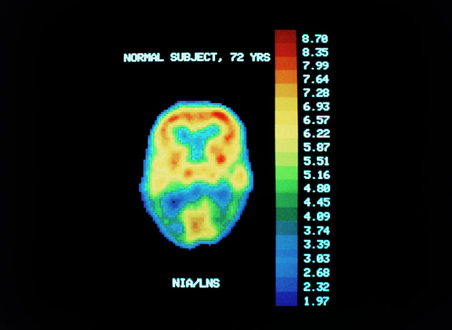 Pet Scan Of Brain Of Normal Subject Photograph by National Institute Of Health/science Photo Library