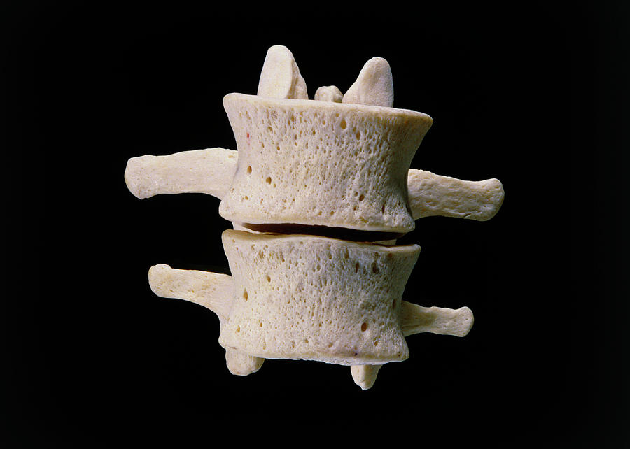 Skeleton Photograph - Photograph Of The Human L3 And L4 Vertebrae by James Stevenson/science Photo Library.
