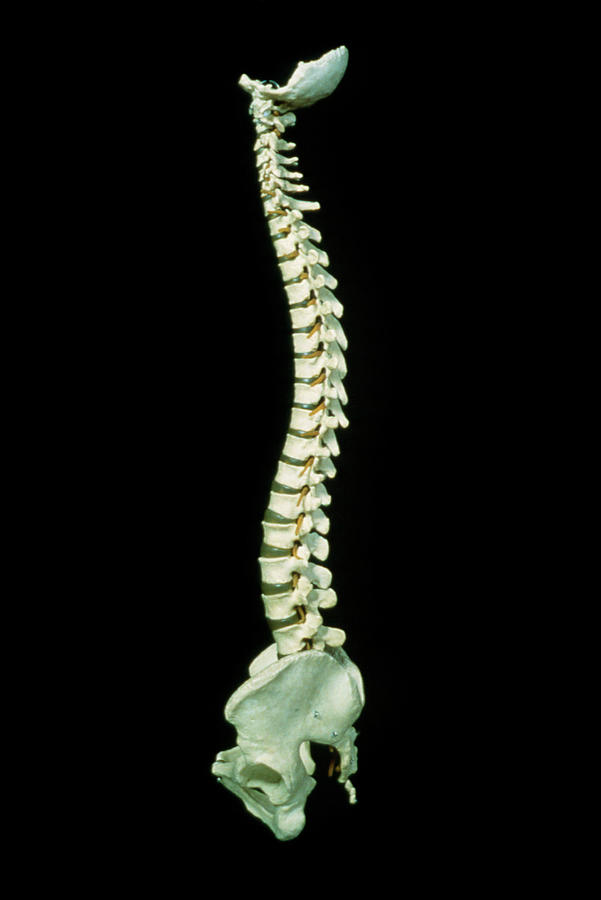 Skeleton Photograph - Photograph Showing The Human Spine & Pelvis by James Stevenson/science Photo Library