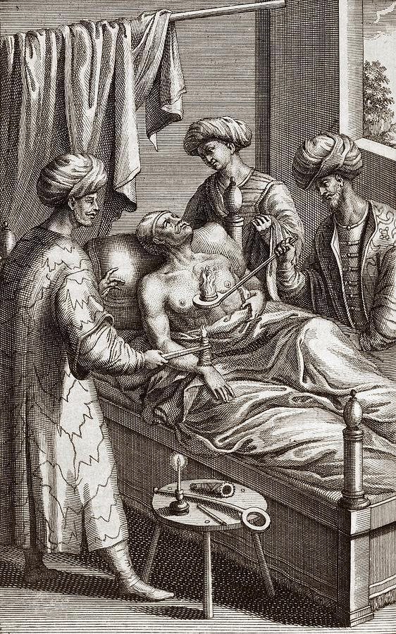 Physicians Performing Hot Cupping Photograph by Royal Institution Of Great Britain / Science Photo Library
