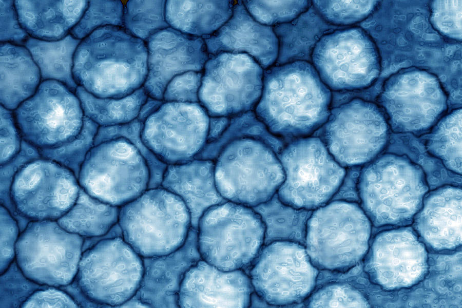 Picornavirus, Tem Photograph by James Cavallini