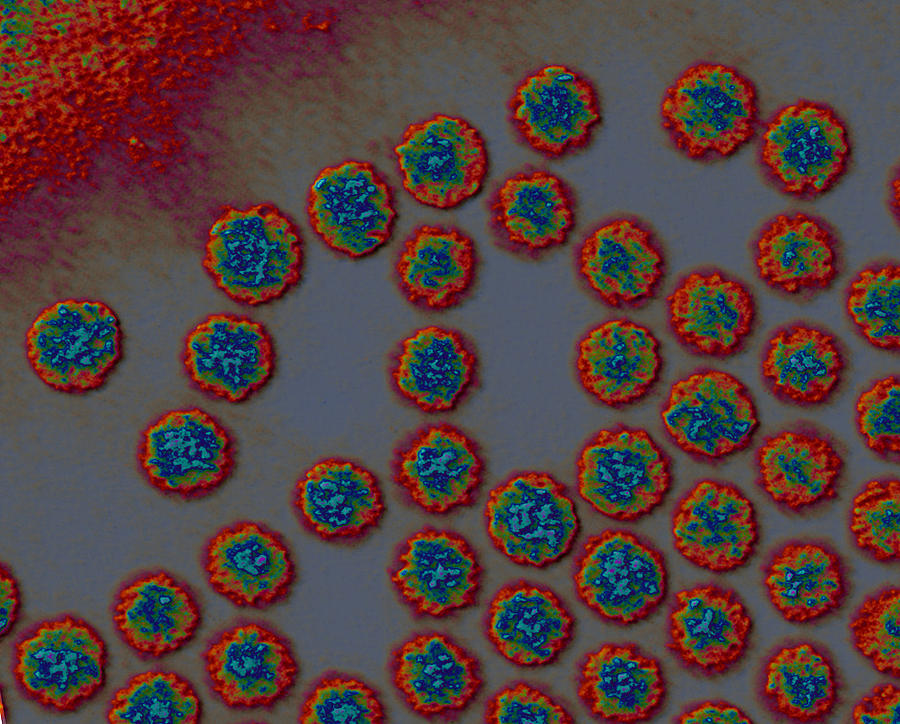 Picornaviruses Photograph by Eye of Science