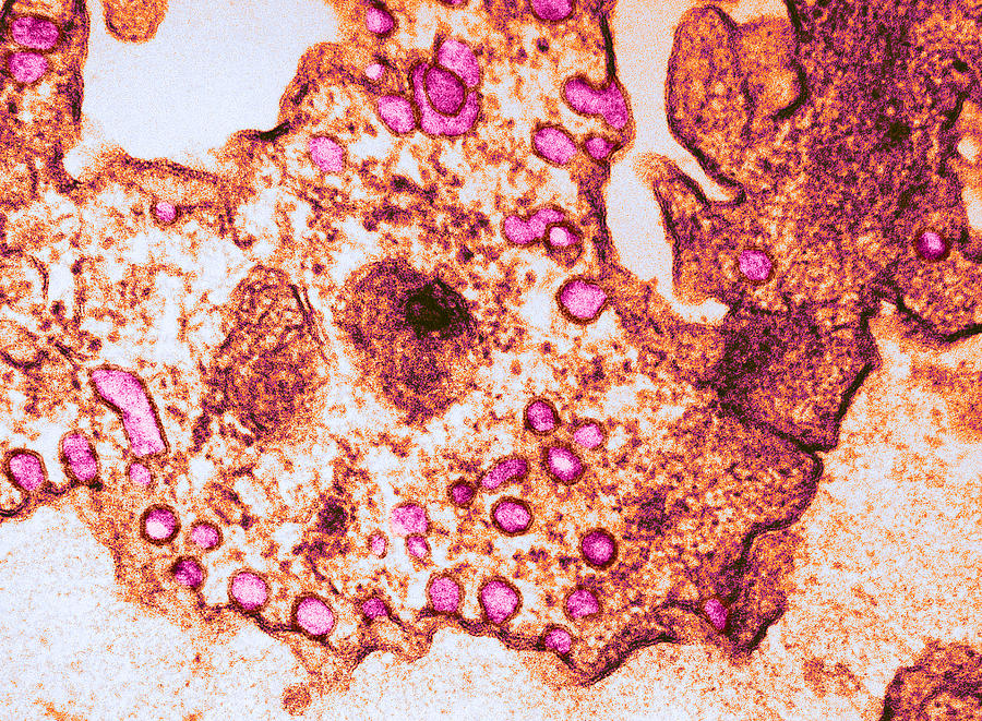 Pinocytosis, Capillary Endothelium, Tem Photograph by Joseph F. Gennaro Jr.