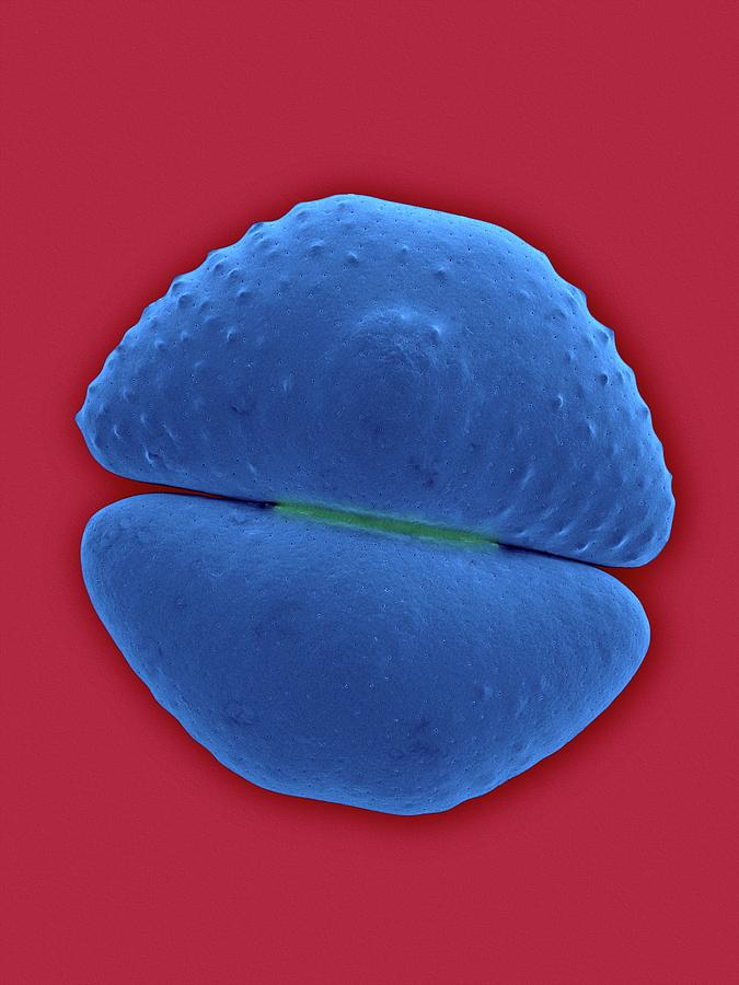 Placoderm Desmid (cosmarium Botrytis) Photograph by Dennis Kunkel Microscopy/science Photo Library