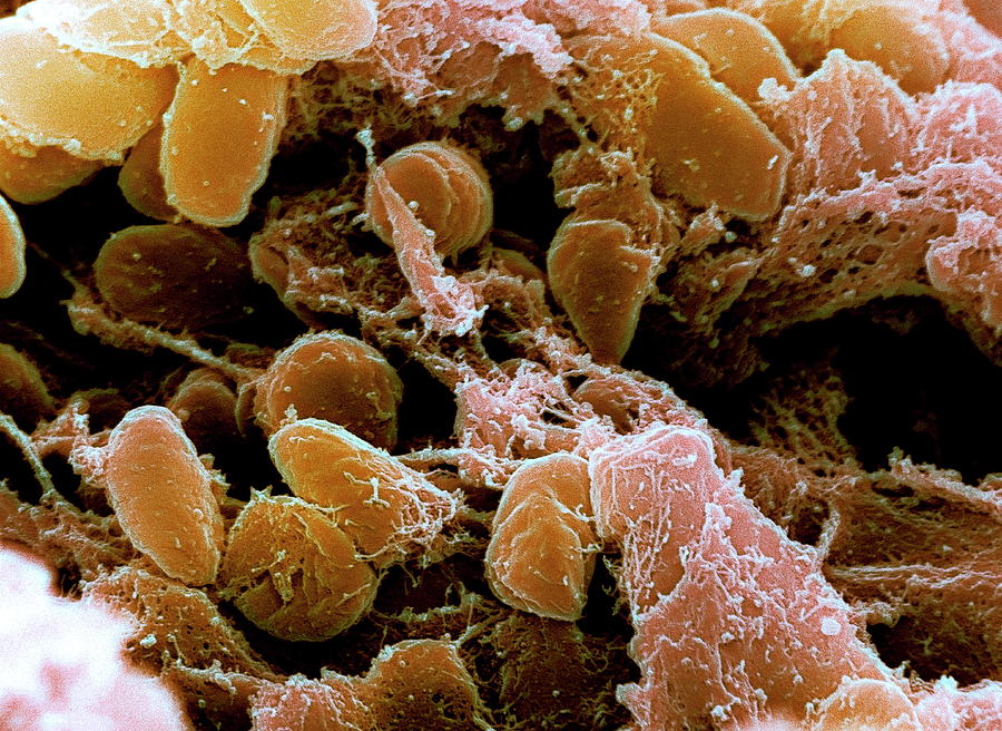 Plague Bacteria Photograph by Niaid/cdc/science Photo Library - Pixels ...