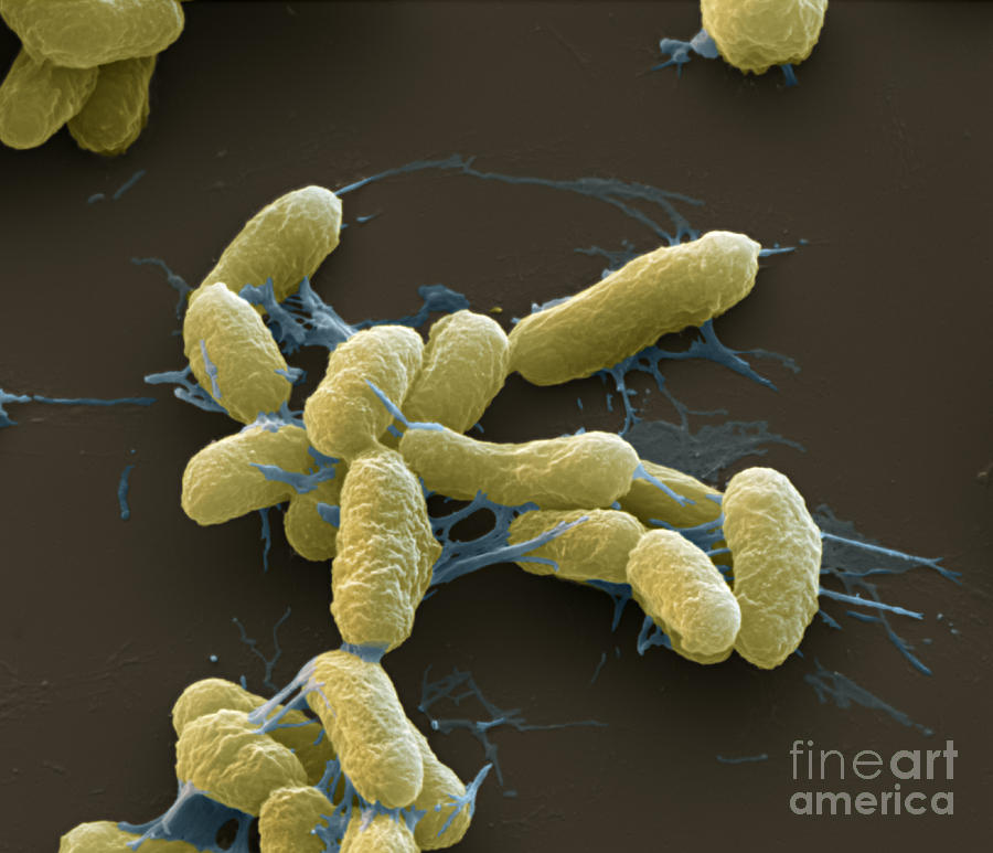 Plague Bacteria Yersinia Pestis Sem Photograph by Eye of Science