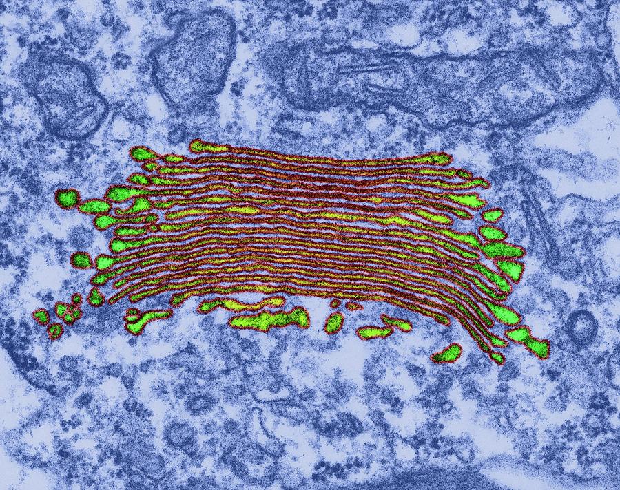 Plants Photograph - Plant (alga) Golgi Apparatus by Dennis Kunkel Microscopy/science Photo Library Plants Photograph - Plant (alga) Golgi Apparatus by Dennis Kunkel Microscopy/science Photo Library