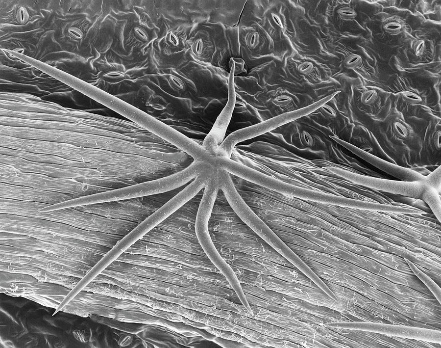 Plant Leaf Trichome (hibiscus Sp.) Photograph by Dennis Kunkel Microscopy/science Photo Library