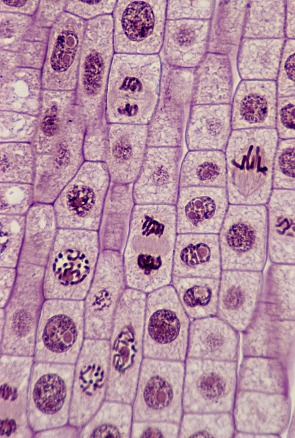 PLANT MITOSIS; ALL PHASES, ONION (Allium) ROOT TIP, 200X at 35mm, Interphase, Prophase, Metaphase, Anaphase, Telophase. Photograph by Ed Reschke PLANT MITOSIS; ALL PHASES, ONION (Allium) ROOT TIP, 200X at 35mm, Interphase, Prophase, Metaphase, Anaphase, Telophase. Photograph by Ed Reschke
