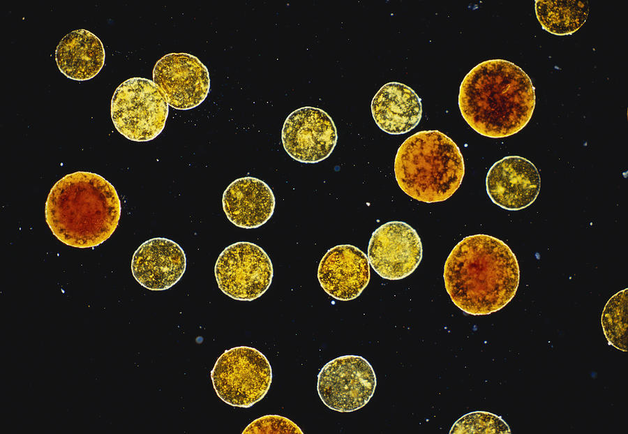 Plant Spores, Dark Field Microscopy Photograph by Michael Abbey