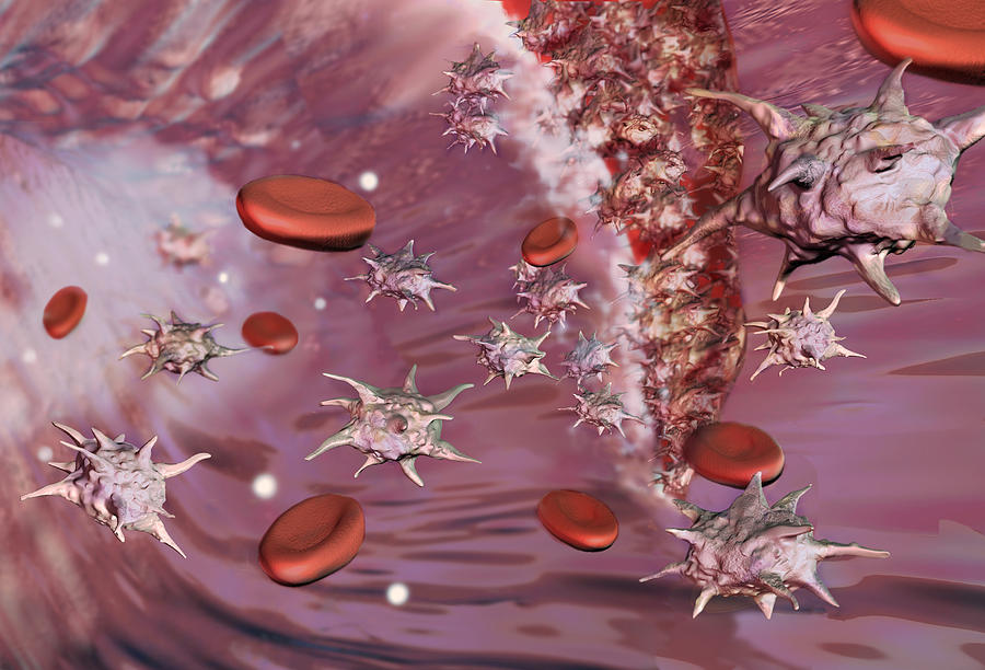 Platelets, Illustration Photograph by Spencer Sutton
