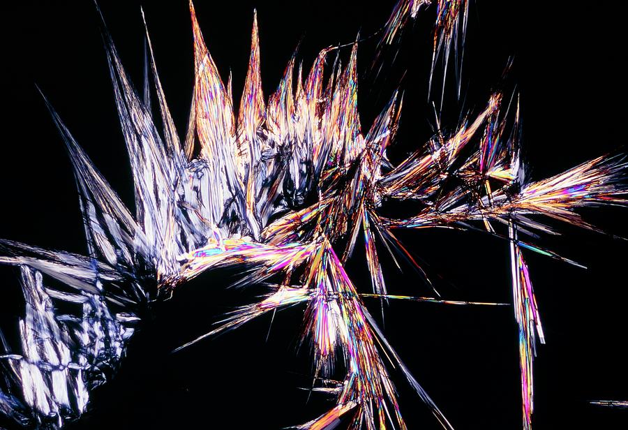 Plm Of Crystals Of Cholesterol Photograph By Sidney Moulds Science   Plm Of Crystals Of Cholesterol Sidney Mouldsscience Photo Library 