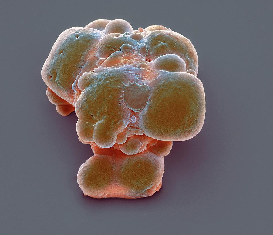 Biochemical Photograph - Pluripotent Stem Cells by Steve Gschmeissner