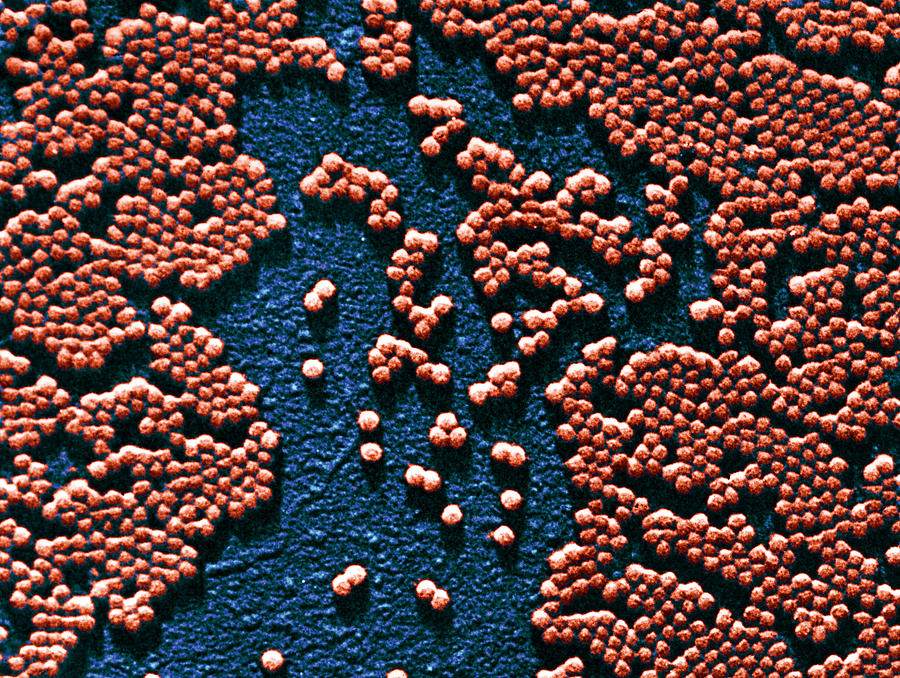 Polio Virus, Tem Photograph by Omikron