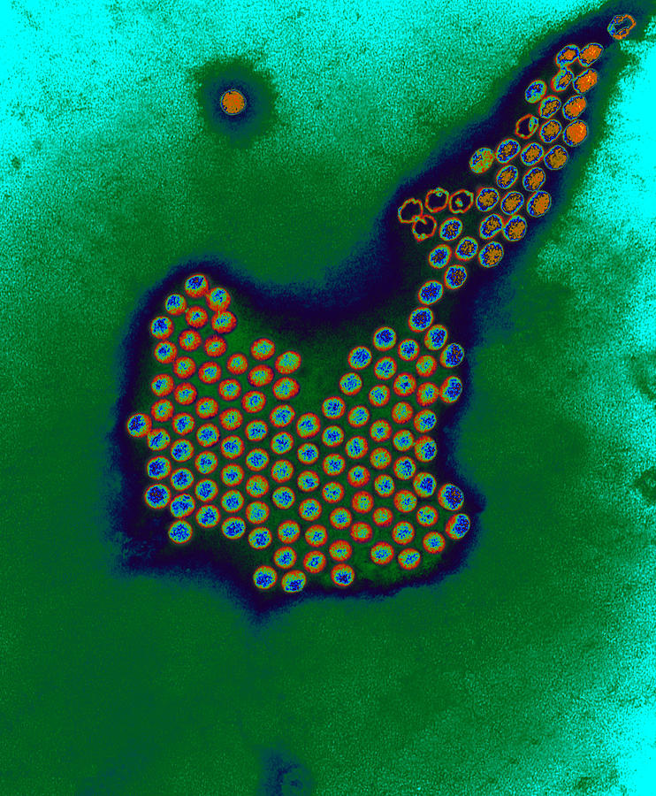 Polio Viruses Photograph by Eye of Science