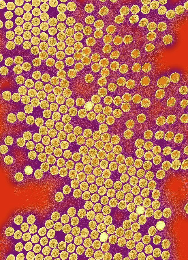 Poliovirus Particles Photograph by Ami Images/science Photo Library