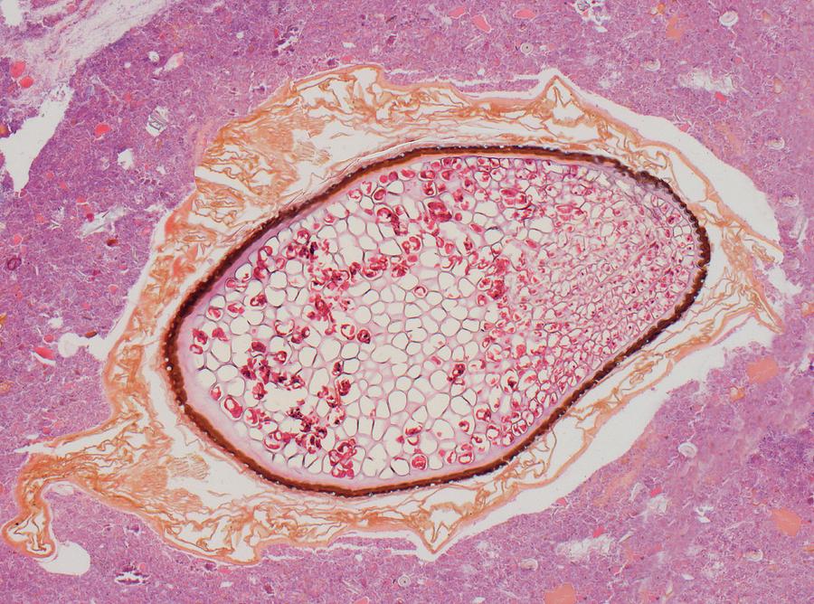 Pollen Grain In Nose Photograph by Steve Gschmeissner