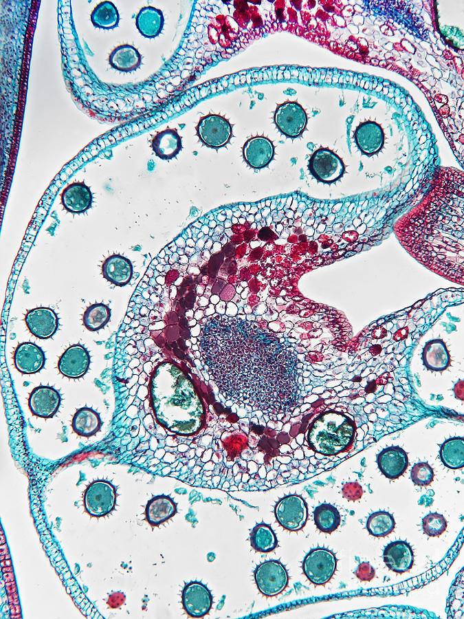 Pollen Packets In Cotton, Gossypium, Lm Photograph by Garry DeLong