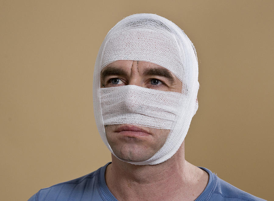 Portrait of a man with a bandaged face Photograph by Uwe Umstatter